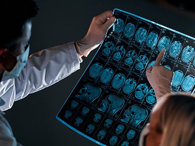 Modelli predittivi del declino cognitivo: una nuova frontiera nella ricerca sull’Alzheimer