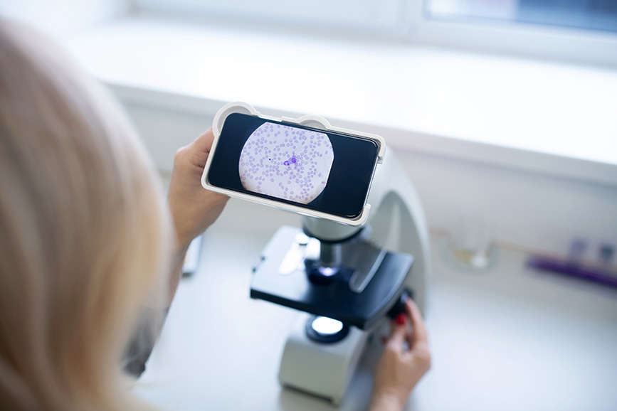 La scoperta di un meccanismo cellulare offre speranza per il trattamento dell’Alzheimer